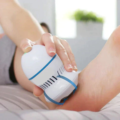 Senvora Vacuum Callus Remover