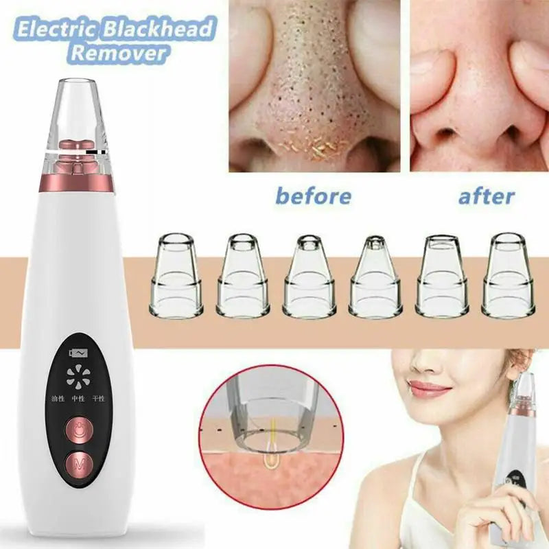 Senvora PureVac Pore Cleaner – genuine supplier image 1